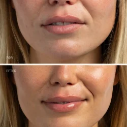 Sanzi Beauty Protecting Lip Balm 15 ml