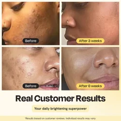 Gleamin - 15% Vitamin C Superactive Serum, 30 ml