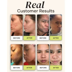 Gleamin - Vitamin C Clarifying Brightening Cleanser, 100 ml